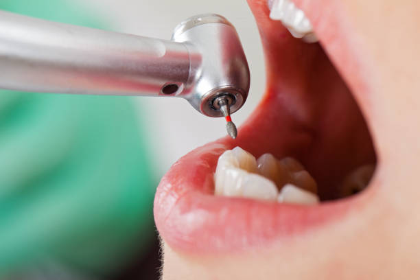 Best Dentist for Tooth Abscess  in Arlington, OH